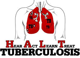 Treatment centre advised for MDR-TB