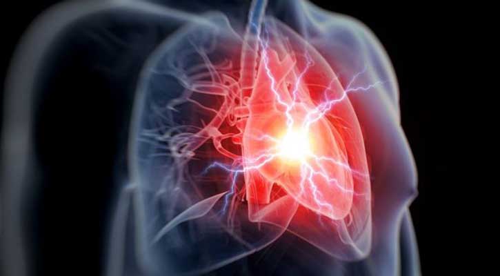 Anti-inflammatory drug ‘cuts heart attack risk’