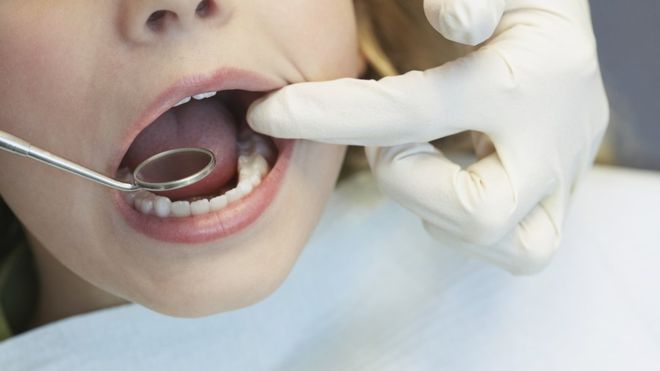 Dental surgeons urge schools to go sugar-free