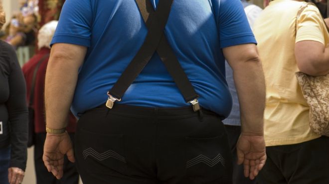 Obesity causes more cases of some cancers than smoking
