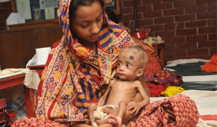 Bangladesh now part of success in malnourished children treatment