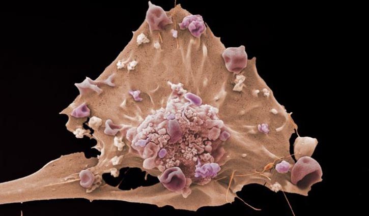 Scientists seek clues to how cancer ‘is born’