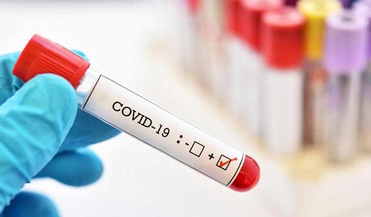 30 more test coronavirus positive in M'singh division