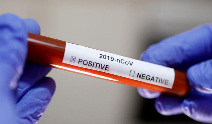 Researchers claim 20-minute blood test to detect virus