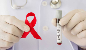 Dhaka secures top position in detecting AIDS in country