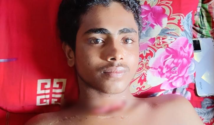 He was shot dead and lying on the street, free, meaning treatment was off