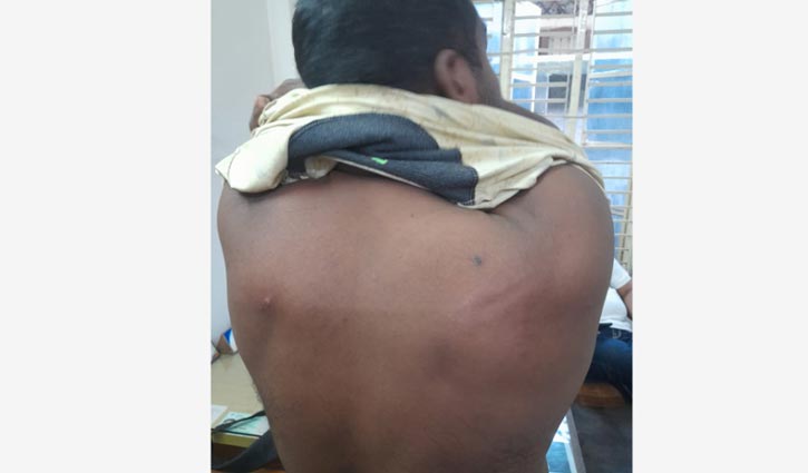 Allegation of attack on journalist in Jessore