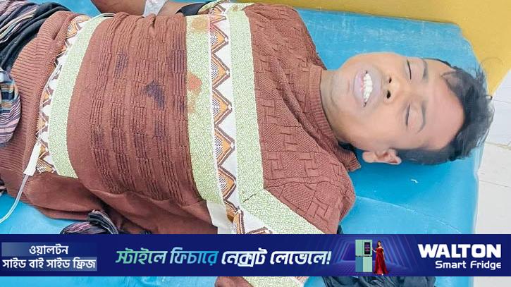 খুলনায় বাড়ি থেকে ডেকে নিয়ে যুবকের কব্জি কর্তন