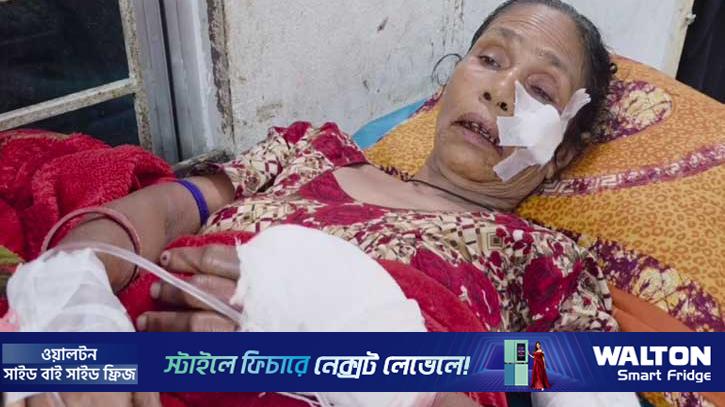 গোপালগঞ্জে ককটেল বিস্ফোরণে নারী আহত