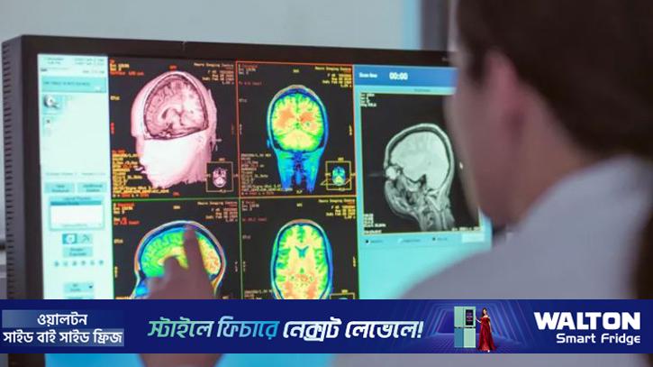 মানুষের মস্তিস্কের বয়ঃসন্ধিকাল ৩০ বছর পর্যন্ত স্থায়ী হয়