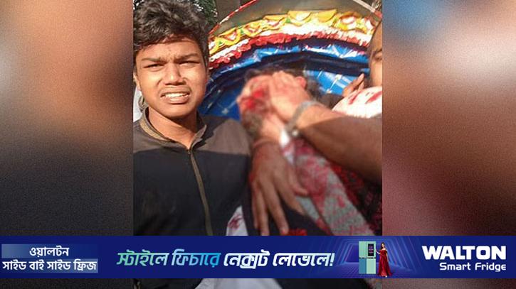 ঢাকা মেডিকেল থেকে এভারকেয়ারে নেওয়া হচ্ছে হাদিকে