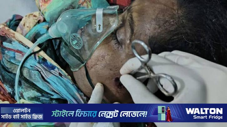 অন্য নারীর ঘরে ধরা, পালানোর সময় ছোড়া গুলিতে আহত ২