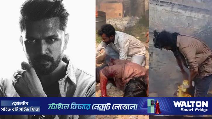 শুটিং সেটে আগুনে দগ্ধ আরিফিন শুভ