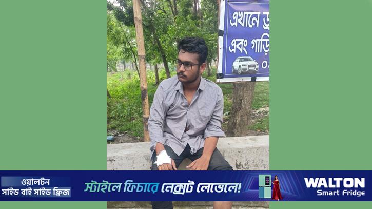 বাকৃবিতে মতাদর্শের দ্বন্দ্বে মারধরের অভিযোগ