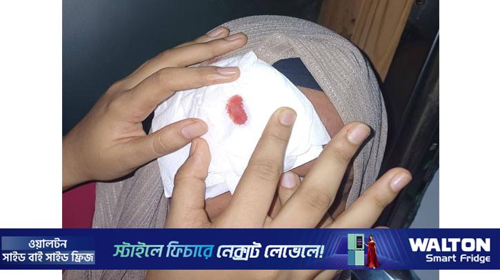 চবি শাটলে পাথর নিক্ষেপ, আহত শিক্ষার্থী