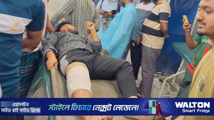 বাড়ির সামনে মুখোশধারীদের গুলিতে জামায়াত কর্মী আহত