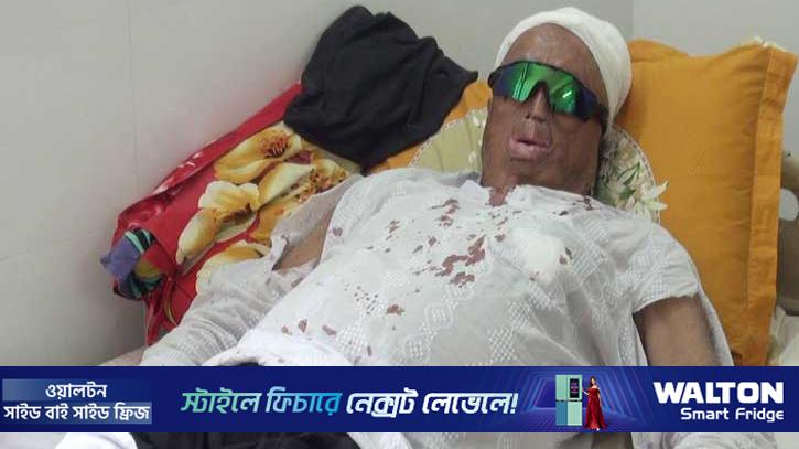 গোপালগঞ্জে সাবেক ইউপি চেয়ারম্যানকে কুপিয়ে জখম