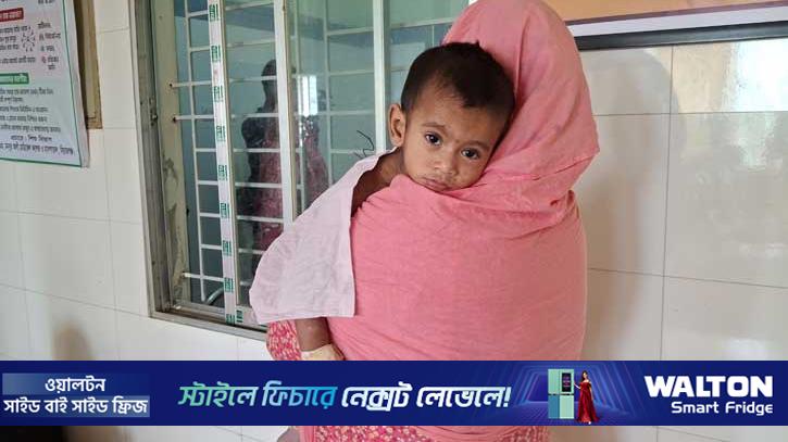 সিরাজগঞ্জে হামের উপসর্গে আক্রান্ত ১৬ রোগী হাসপাতালে ভর্তি