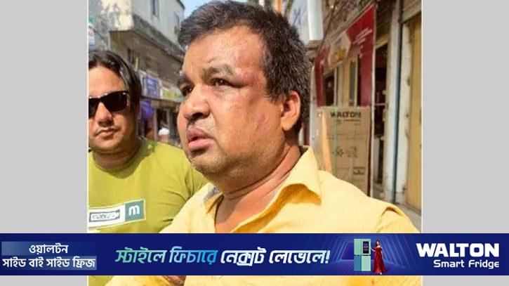 ভুয়া ভেবে ভ্যাট পরিদর্শককে পিটিয়ে বেঁধে রাখল ব্যবসায়ী