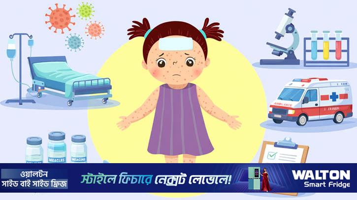 দেশে-দেশে ফিরে আসছে হাম, কারণ কী?