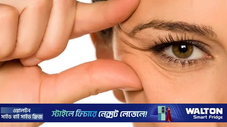 ত্বকে বলিরেখা পড়ছে? যেসব অভ্যাস দায়ী