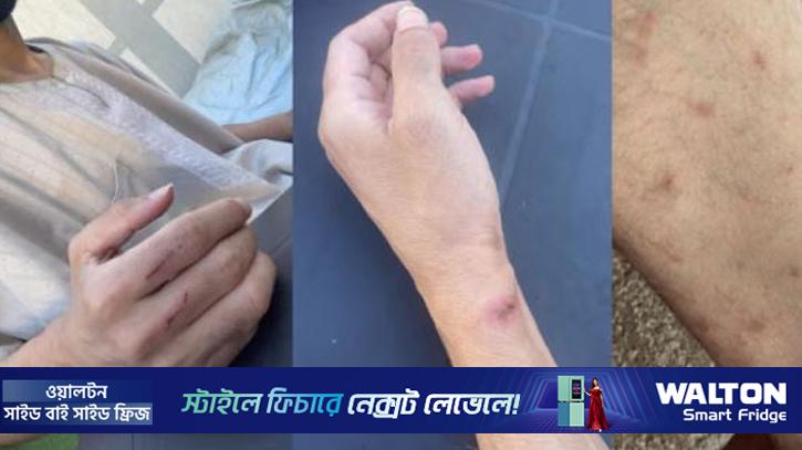 ইসরায়েলের কারাগারে মারধর, অনাহার ও ধর্ষণের শিকার ৬০ সাংবাদিক