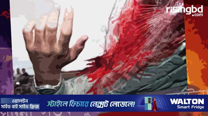 সড়ক বিভাজকে বেপরোয়া গতির মোটরসাইকেলের ধাক্কা, তরুণ নিহত