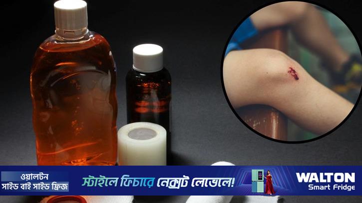 মেয়াদোত্তীর্ণ ‘অ্যান্টিসেপটিক’ ব্যবহার কতটা নিরাপদ?