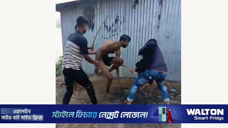 চুরির অপবাদ দিয়ে পিটিয়ে তরুণের পা ভেঙে দেওয়ার অভিযোগ