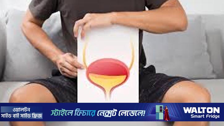 রমজানে প্রস্রাবে জ্বালাপোড়ার সমস্যা বেড়েছে? বিশেষজ্ঞের পরামর্শ