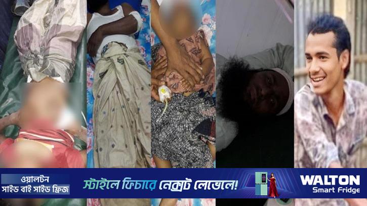 টেকনাফে বিএনপির নির্বাচনি প্রচারে গুলি, শিশুসহ আহত ৫