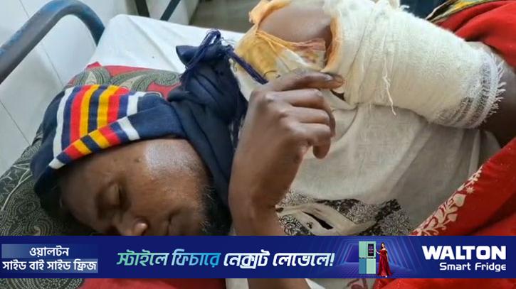 ফরিদপুরে জামায়াতকর্মীকে ছুরিকাঘাত-হাতুড়িপেটার অভিযোগ