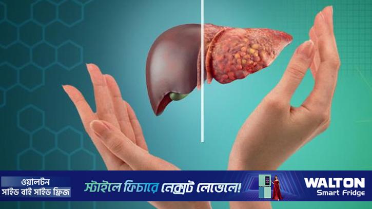 ওবেসিটি থেকে ফ্যাটি লিভার: নীরব বিপদের লক্ষণ চিনুন