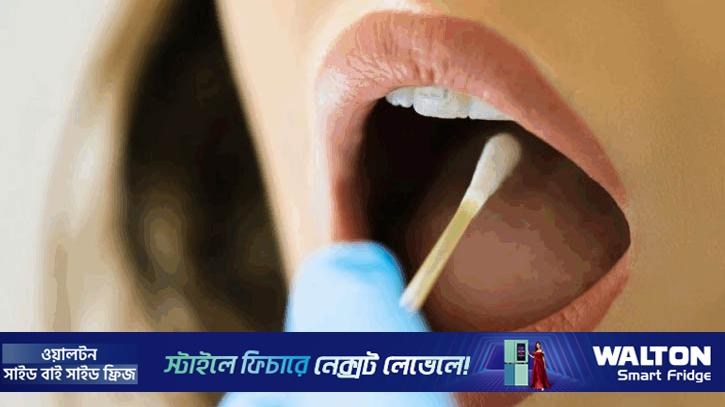 মুখের ক্যান্সারের লক্ষণগুলো দেখা দিলে সতর্ক হোন