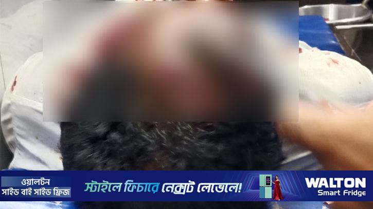 ইবি কর্মকর্তার সঙ্গে হাতাহাতি, আহত ভ্যানচালক