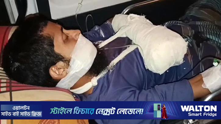 গোপালগঞ্জে ‘বোমা’ বানানোর সময় বিস্ফোরণ, ছাত্র আহত