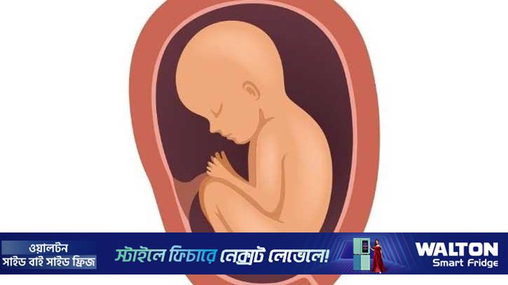 সিলেটে মায়ের গর্ভেই মারা গেছে ১০ হাজার শিশু