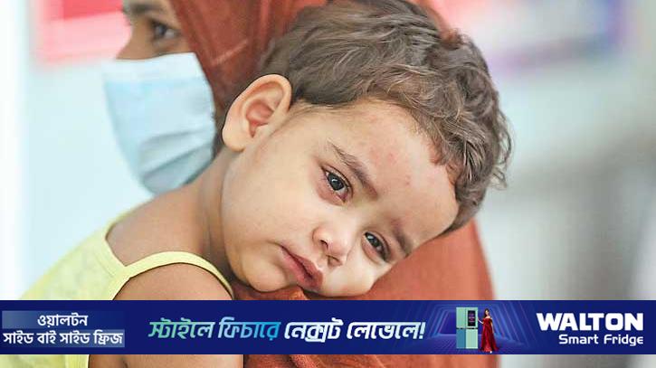 ২৪ ঘণ্টায় হামে মৃত্যু ১২, আক্রান্ত ৯৭৪