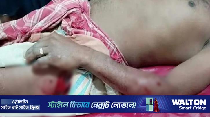 কুষ্টিয়ায় শরীরে পেরেক ঢুকিয়ে মধ্যযুগীয় কায়দায় নির্যাতনের অভিযোগ