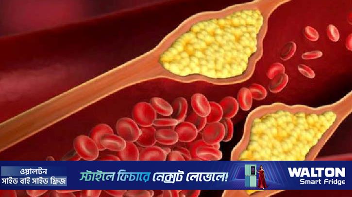 রক্তে খারাপ কোলেস্টেরল বেড়ে গেলে করণীয়