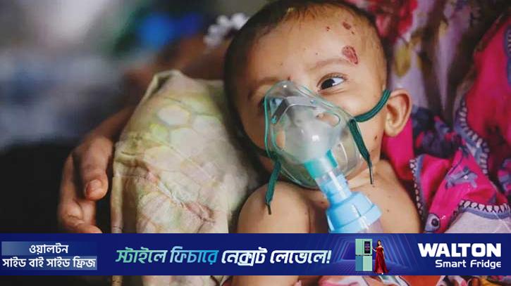 হামের সঙ্গে নিউমোনিয়ায় আক্রান্ত শিশুদের অবস্থা জটিল হচ্ছে