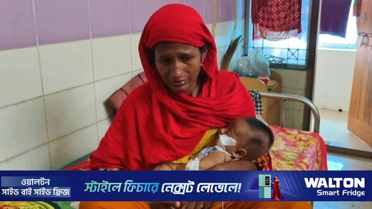 হামের লক্ষণ নিয়ে মমেকে আরো ২৬ শিশু ভর্তি