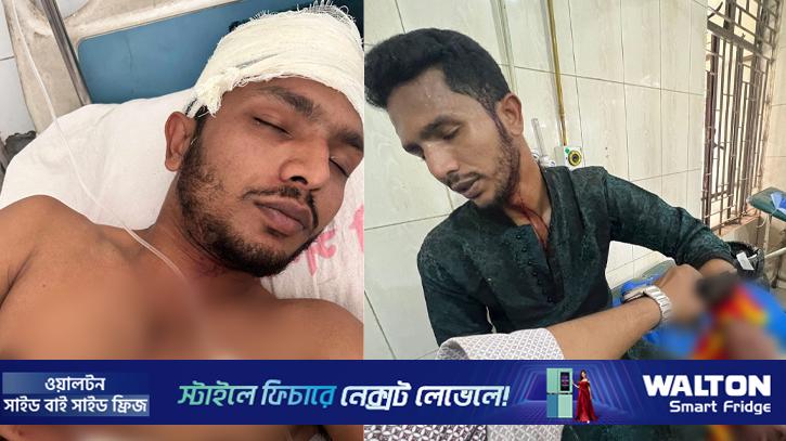 ছাত্রদল নেতার উপস্থিতে কর্মীর ‘রগ কর্তন’, আবির কি ছাত্রলীগের